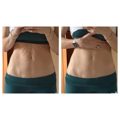 cryo Thermo Firming Gold Gel