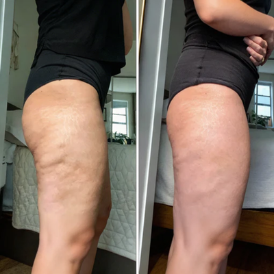 cryo Thermo Firming Gold Gel