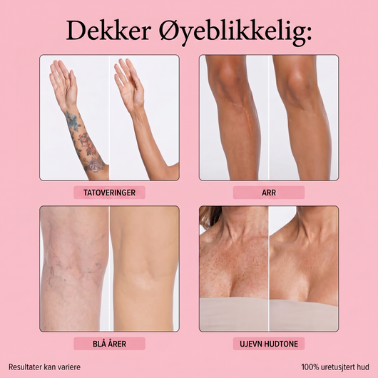 Kroppsdekning perfektor